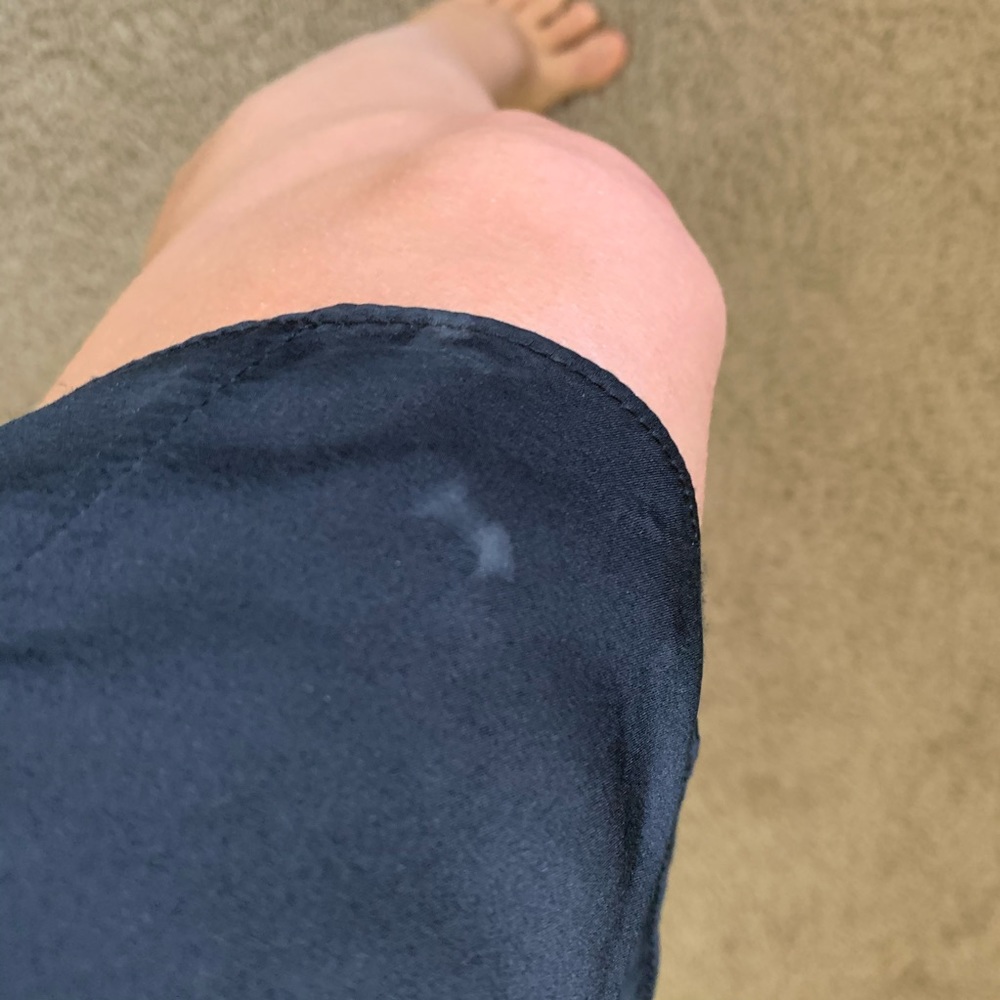 Rag and bone dress 2 - Picture 3 of 5